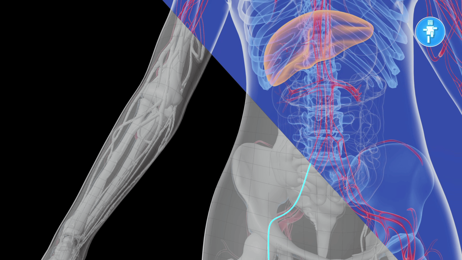 Modélisation 3D médicale - Lampyre Studio