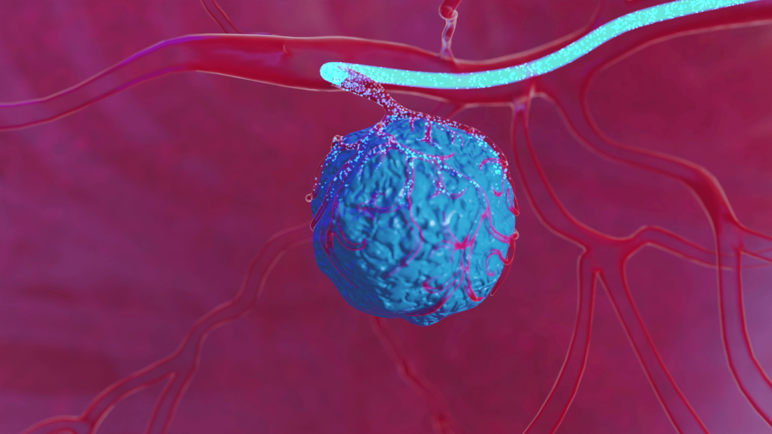 Visualisation 3D médicale - oncologie